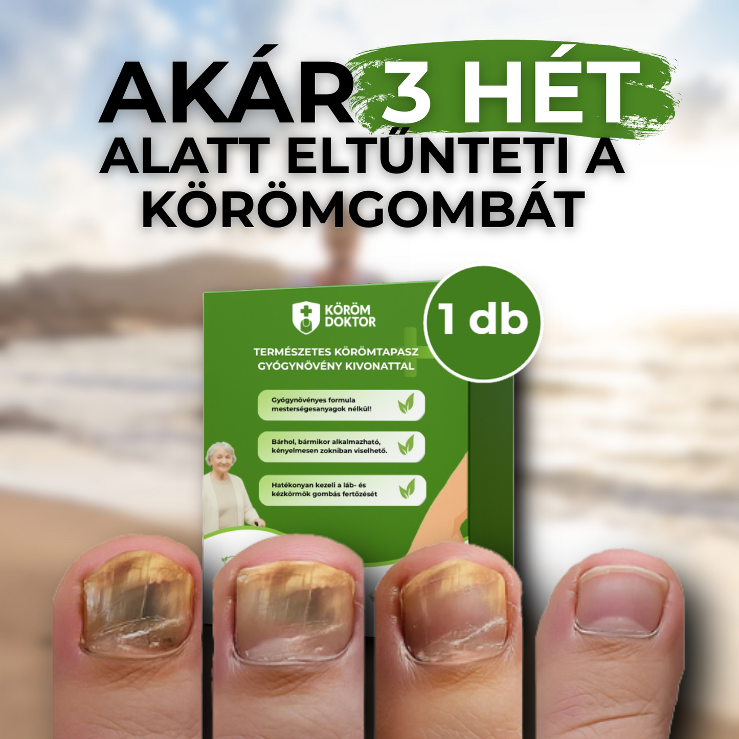 Körömgomba Elleni Tapasz